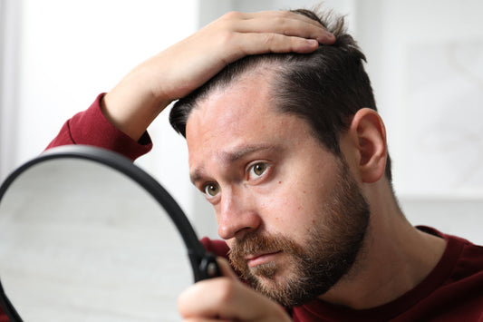 Man examining hairline in mirror concerned about hair thinning and possible link to creatine supplementation